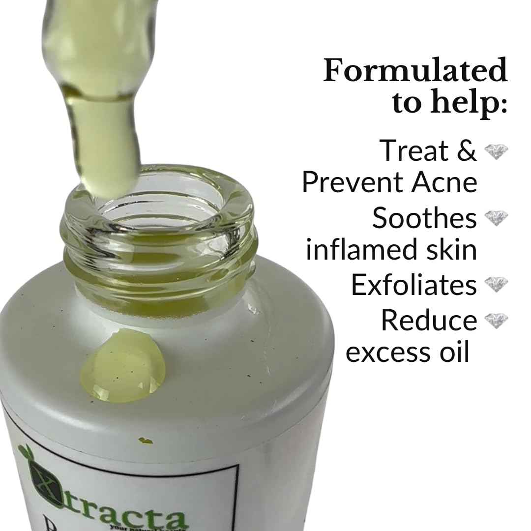 Xtracta Pore Control Serum for Acne-Prone Skin – Salicylic Acid, Azelaic Acid, Colloidal Sulfur & Ginkgo – Plant-Based Oil & Blackhead control, 30ml