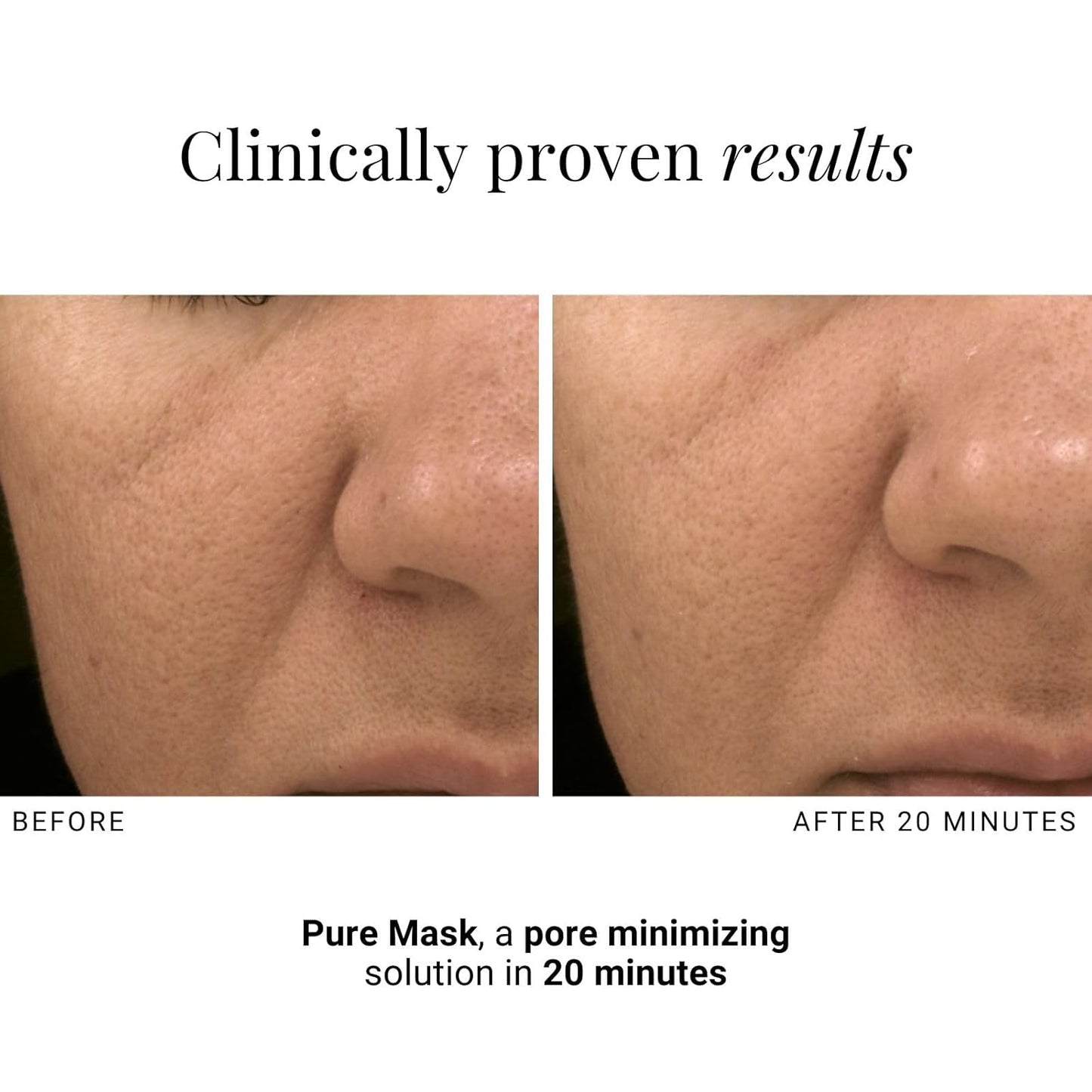 G.M. COLLIN Purifying Clay Mask with Salicylic Acid - Oil Control & Pore Minimizing for Oily Skin | Redness Relief