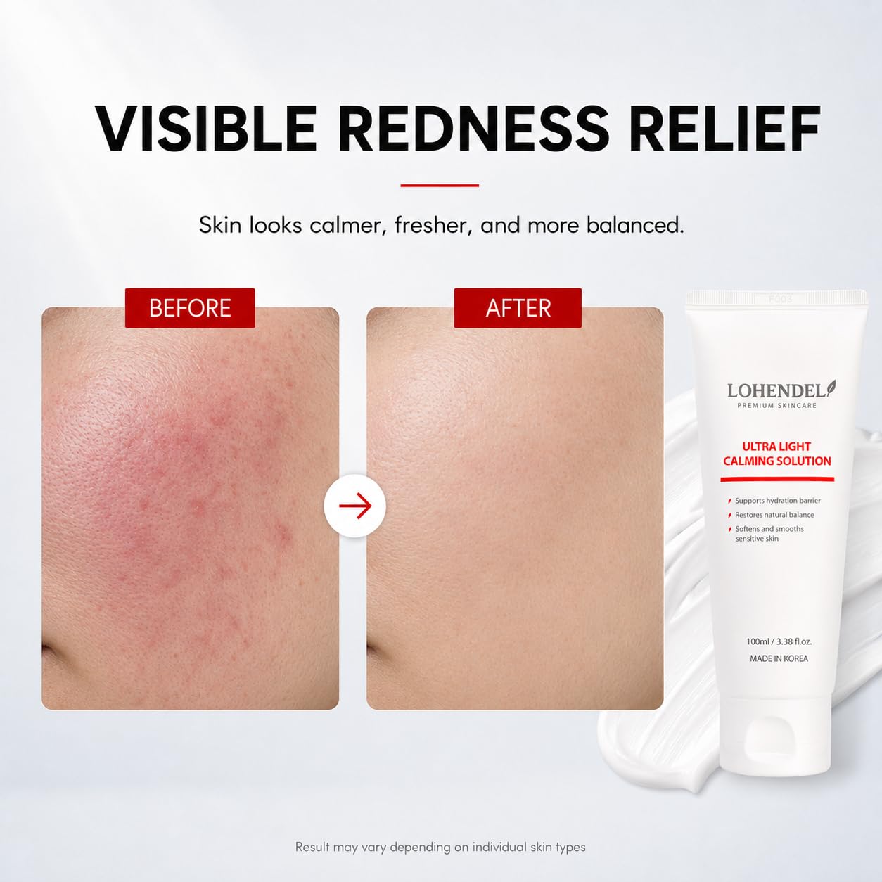 LOHENDEL Ultra Light Calming Solution - Soothe Redness, Repair Barrier