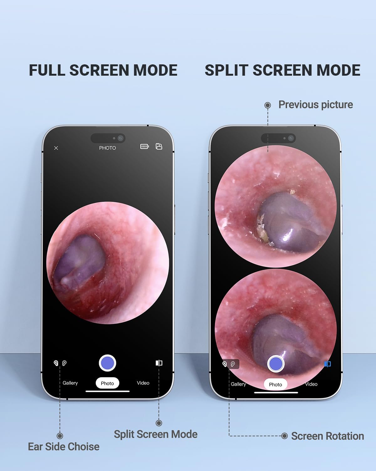 Wireless Otoscope - Dual View Ear Camera with Gyroscope & Light | 3.9mm Ear Scope for Kids, Adults & Pets, iPhone & Android Compatible
