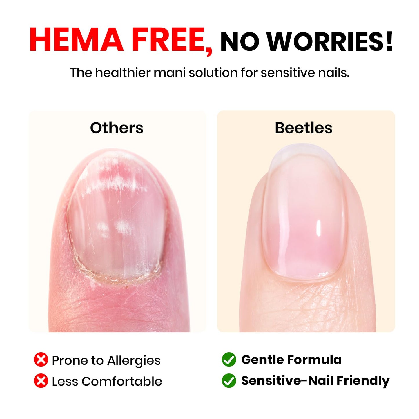 Beetles Gel Base Coat for Nails 15ml, HEMA Free TPO Free Base Gel Polish, UV LED Soak Off, Long Lasting No Lift Nail Primer, Nail Strengthening Base for Gel Manicure