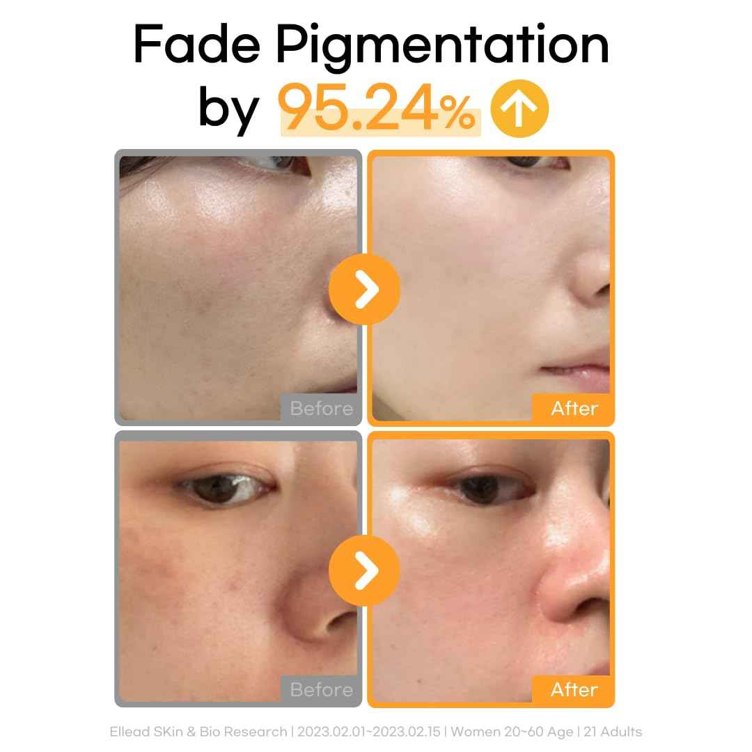 daymellow Vita Ferol 23 Serum 0.67fl.oz/20ml, Vitamin C Face Serum, Vitamin C 23%, Centella, Glutathione, Brightening, for Sensitive Skin, Acne, Dark Spots, Uneven Skin, brightening, Korean Skincare