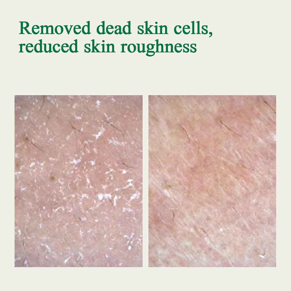 Pyunkang Yul PKY Ultimate Cream & Ampoule/Moisturizer Intensely Calms & Soothes Redness with Cica & Tea Tree, Korean Skincare/Cream(1.01 Fl. Oz, 30ml) & Ampoule(1.01 Fl. Oz, 30ml)