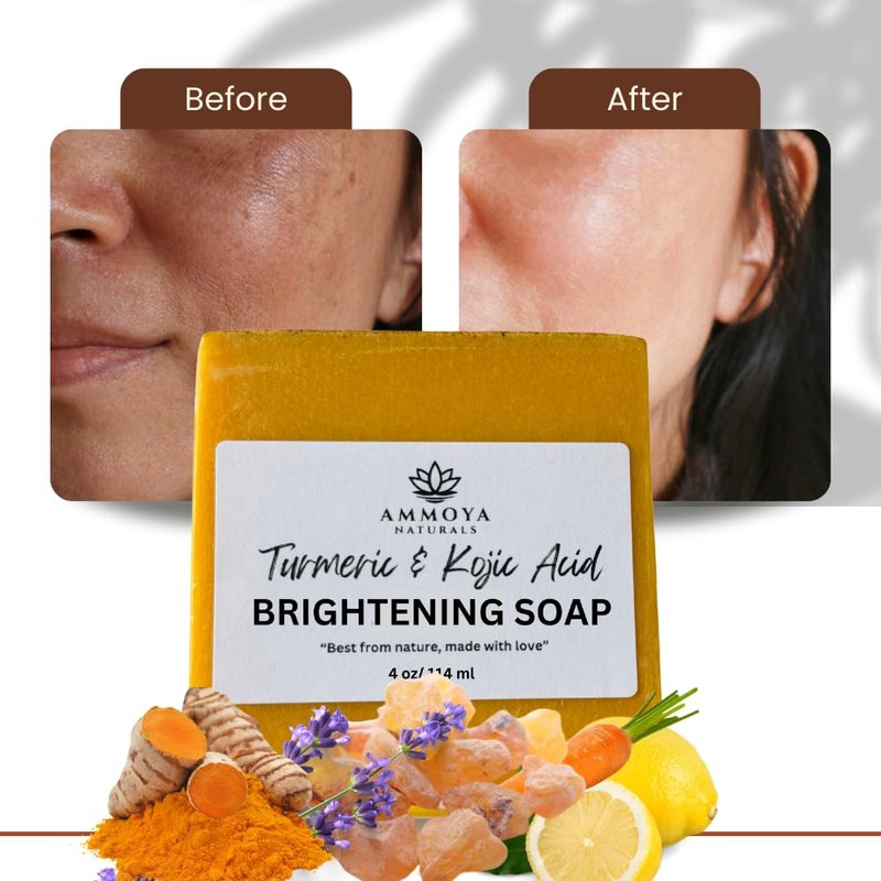 Turmeric Skin Cleansing Soap - Natural Glow Face & Body Cleanser for Acne, Dark Spots & Scars | 3 Bars (4.5 oz)