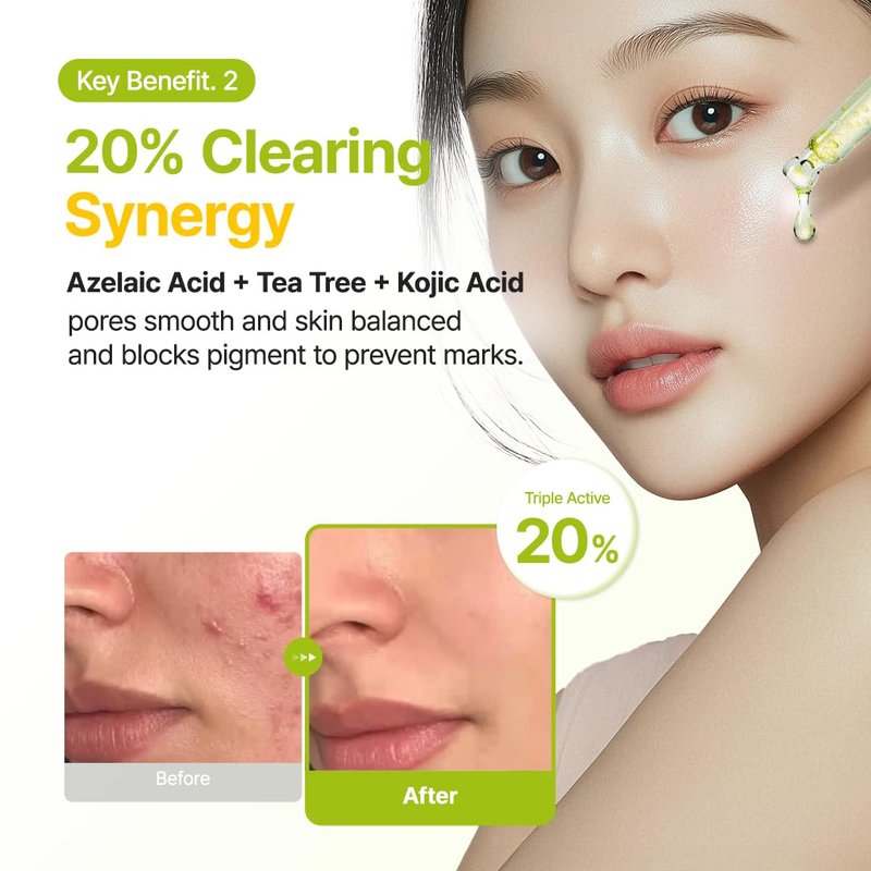 PURITO Azelaic Acid 10% + Kojic Acid + Tea Tree Facial Serum | for Blemish-Prone, Oily & Sensitive Skin | Redness Relief | Korean Skincare, 30mL 1.01 fl.oz