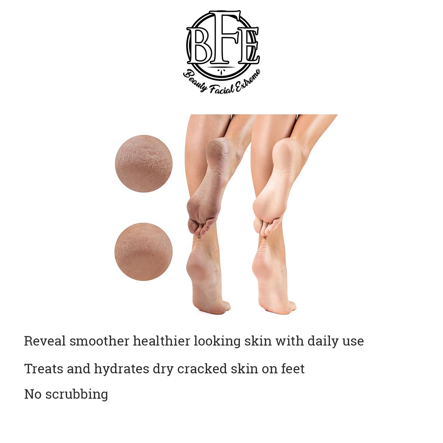 Keratosis Pilaris Exfoliating Body Lotion– 12% Lactic Acid. Provides Immediate Moisture & Gentle Exfoliation to Treat symptoms Associated with Keratosis Pilaris (KP) & Dry, Bumpy Skin Conditions.