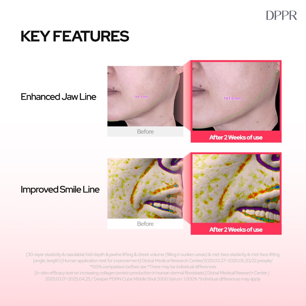 DPPR PDRNCUBE Middleshot 2000 Serum, Facial Serum for Daily Skin Care, Glass Skin, Pink Collagen Serum for Glowy Skin, Serum for Smile Lines, Korean Skincare, Niacinamide(1.01 fl.oz / 30ml)