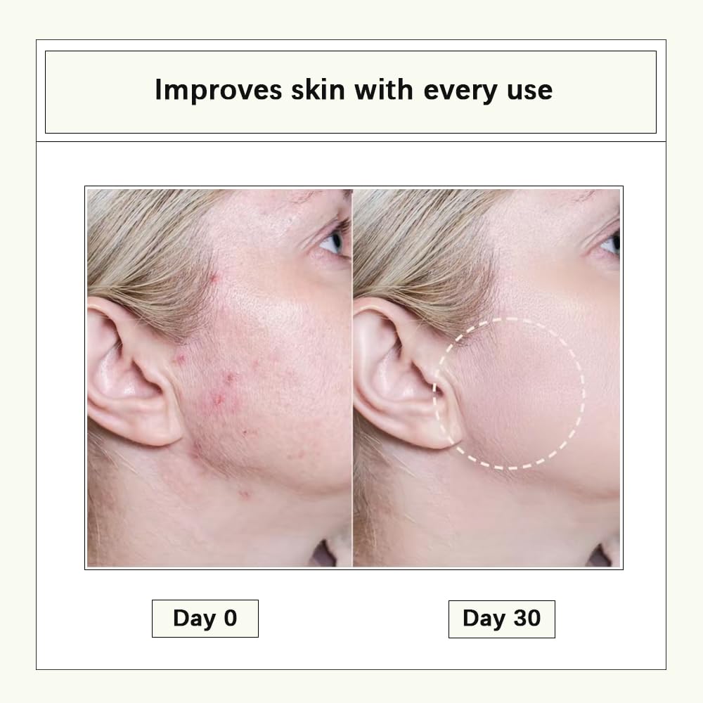 Cistto Natural Cleansing Oil Lightweight Balancing Makeup Remover with Jojoba & Rose Oil, Non-Comedogenic, Travel-Friendly 2ml x 40 Capsules for Oily Skin