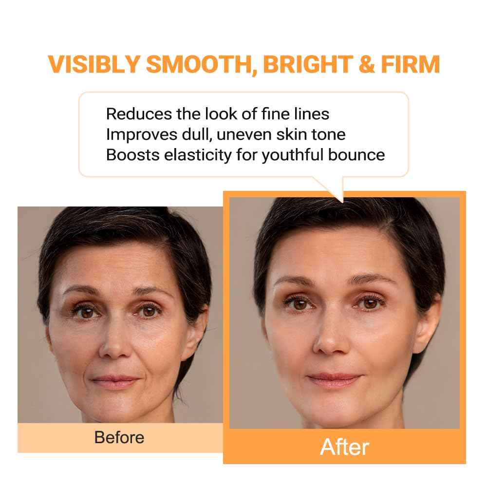 pure.tiful Vitamin B12 Lotion (1 oz) | Repair & Hydrating Cream for All Ages （teen & adult| Soothes Redness, After-Sun Skin Relief, Strengthens Barrier, Sensitive Skin Safe