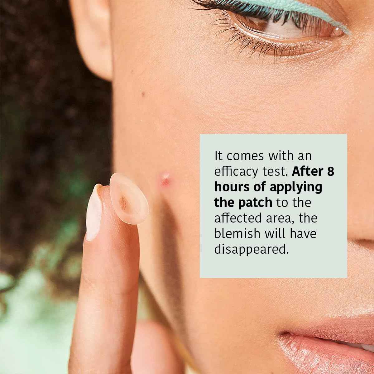 IROHA NATURE Hydrocolloid Pimple Patches with Salicylic Acid (90 Count - Pack of 5), Tea Tree & Centella Asiatica | Reduces Pimples Quickly and Effectively in 8h | Acne Patches