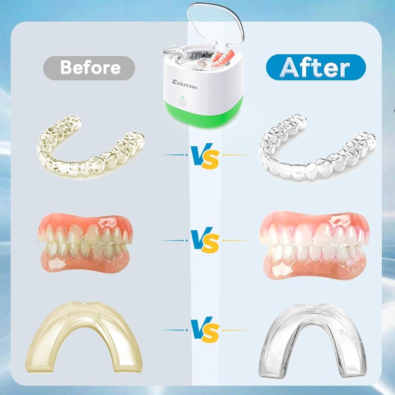 Ultrasonic Retainer Cleaner - 250ML Portable Dental Cleaning Machine for Aligners, Dentures & Jewelry | 45KHz Technology