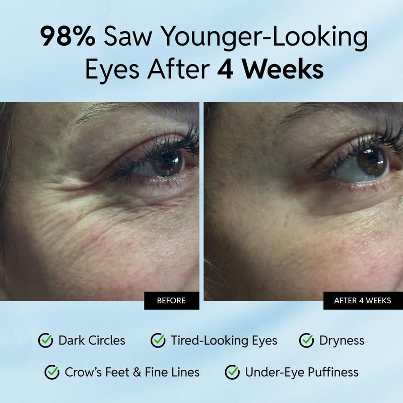 Eliré Anti-Aging Eye Cream - Smooths Wrinkles, Firms and Hydrates - With Ceramides and Caffeine - Reduces Fine Lines and Puffiness - Fast-Absorbing, Invisible Under Makeup - 15ml