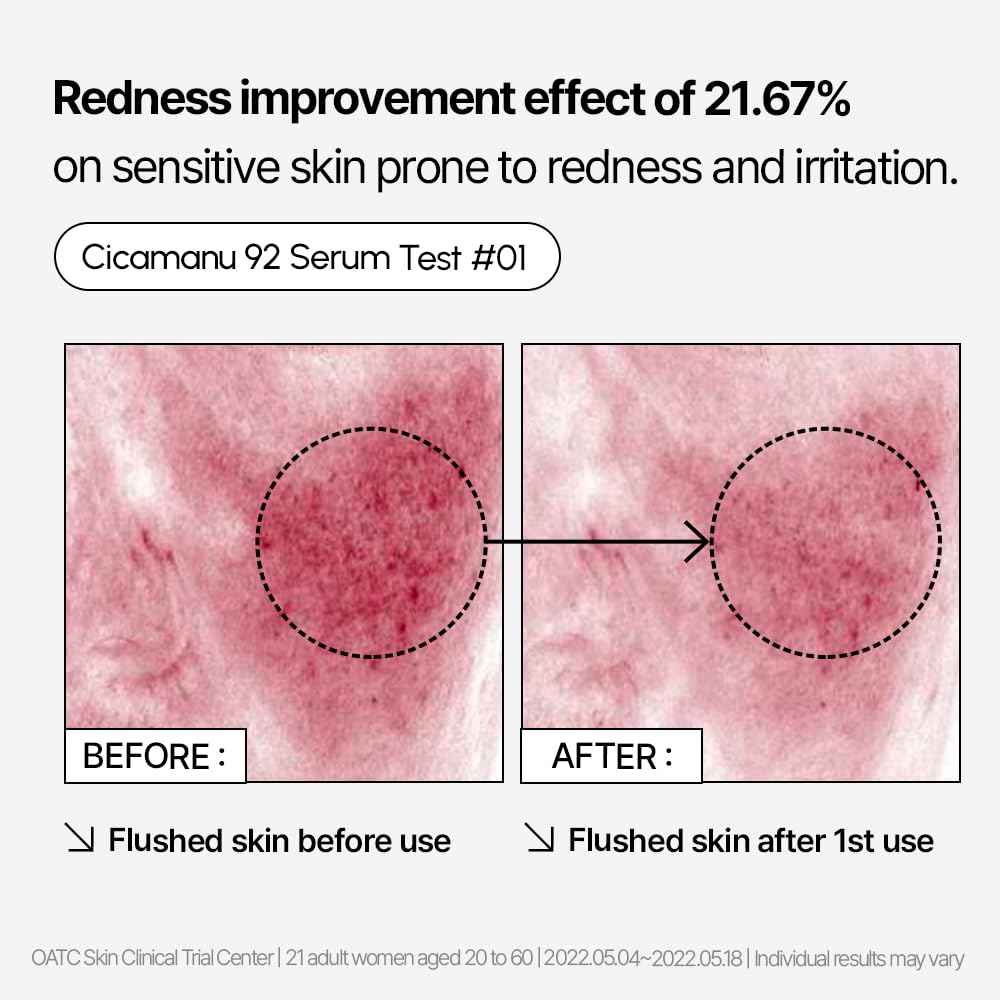 Parnell Cicamanu 92 Serum (1.01 Fl Oz) 30ml | Melatonin, Centella Asiatica | Ceramide for Overnight Recovery & Soothing Irritated Skin | Targets Hyperpigmentation & Deep Hydration | Korean Skin Care