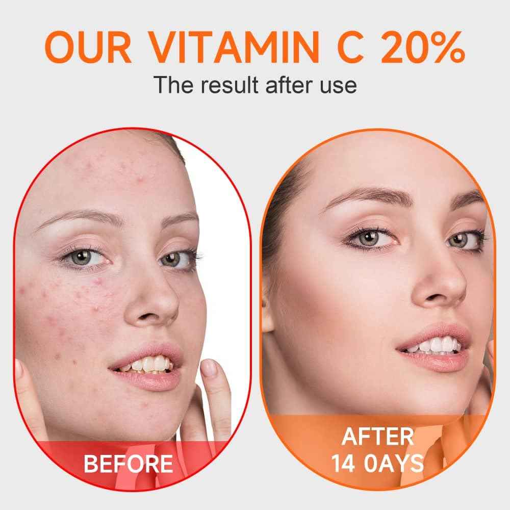 Vitamin c face serum with hyaluronic acid and vitamin e,Skin care, Anti ageing,Anti wrinkles, Smoother and Plumper Skin beauty products 1.35 fl oz