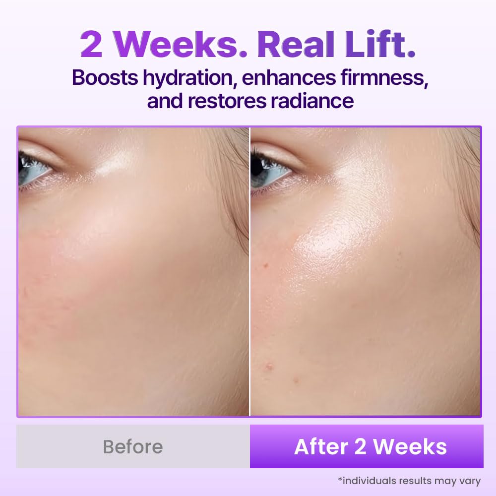 BIOHEAL BOH Probioderm 3D Lifting Cream Mist 3.38 fl oz | Korean Face Mist with Cream-Like Hydration for Instant Glow, Firm-Looking Skin & On-the-Go Refresh