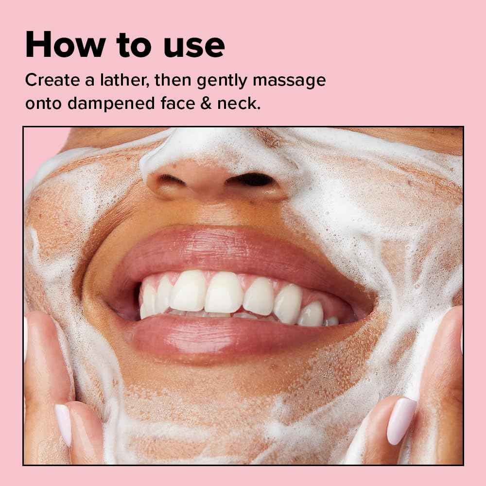 I DEW CARE Acne Facial Foam Cleanser - Namaste Kitten | Clarifying Heartleaf, Makeup Cleansing, Korean Skincare, Vegan, Cruelty-free, Paraben-free, Gentle Face Wash for Dry Skin