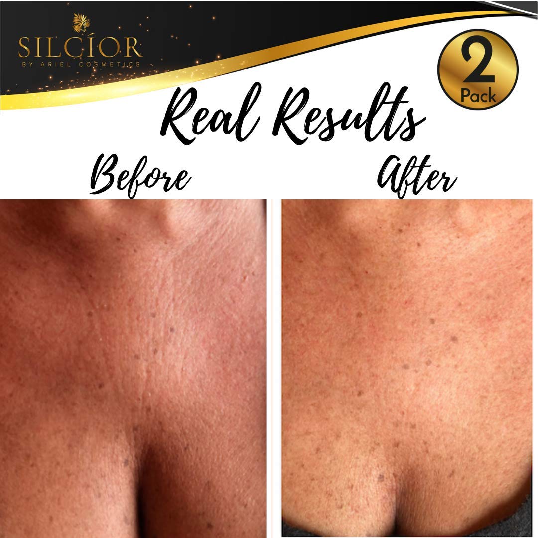 SILCIOR 2 PACK Silicone Chest Wrinkle Pads, Reusable Anti-Wrinkle Decollete Patches, Overnight Chest Smoothing Pads for Fine Lines, Skin-Firming Crepe Pad