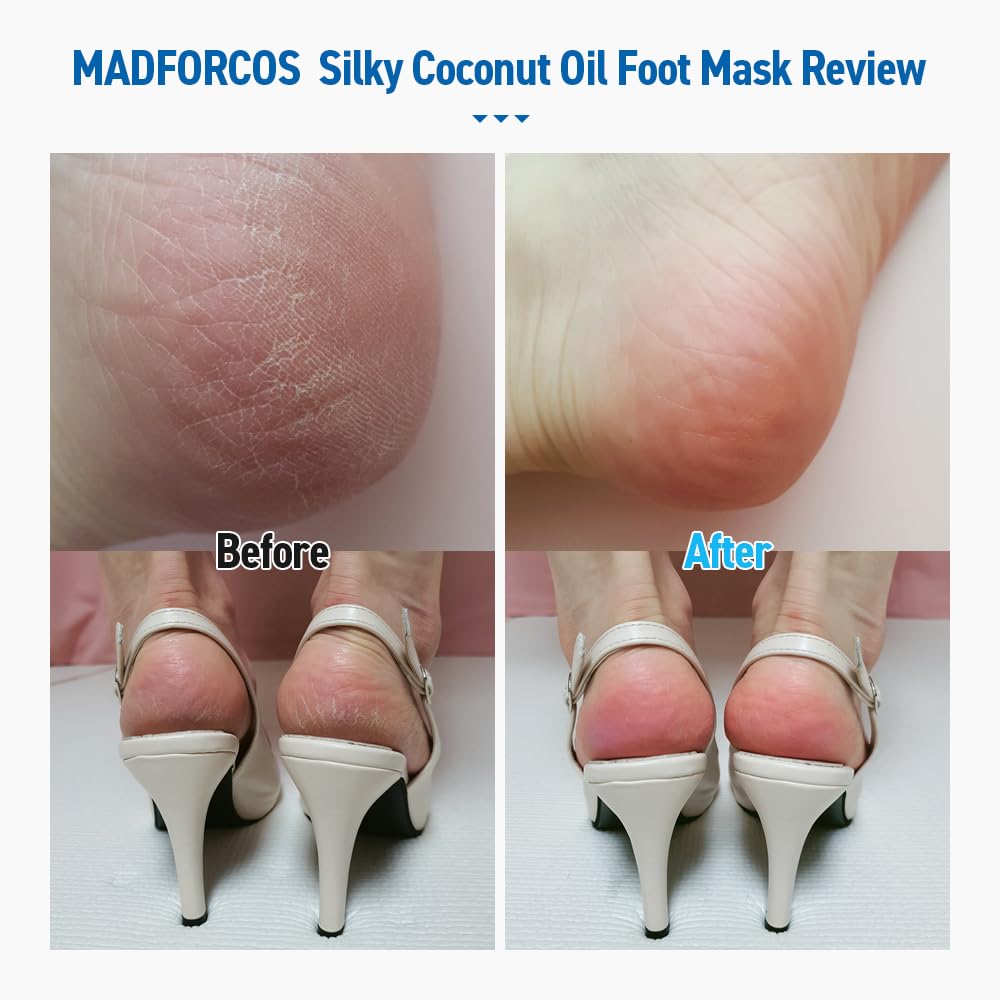 MADFORCOS Moisturizing Foot Mask Socks – Silky Coconut Oil Booties for Dry, Cracked Feet & Heels | 10 Pairs