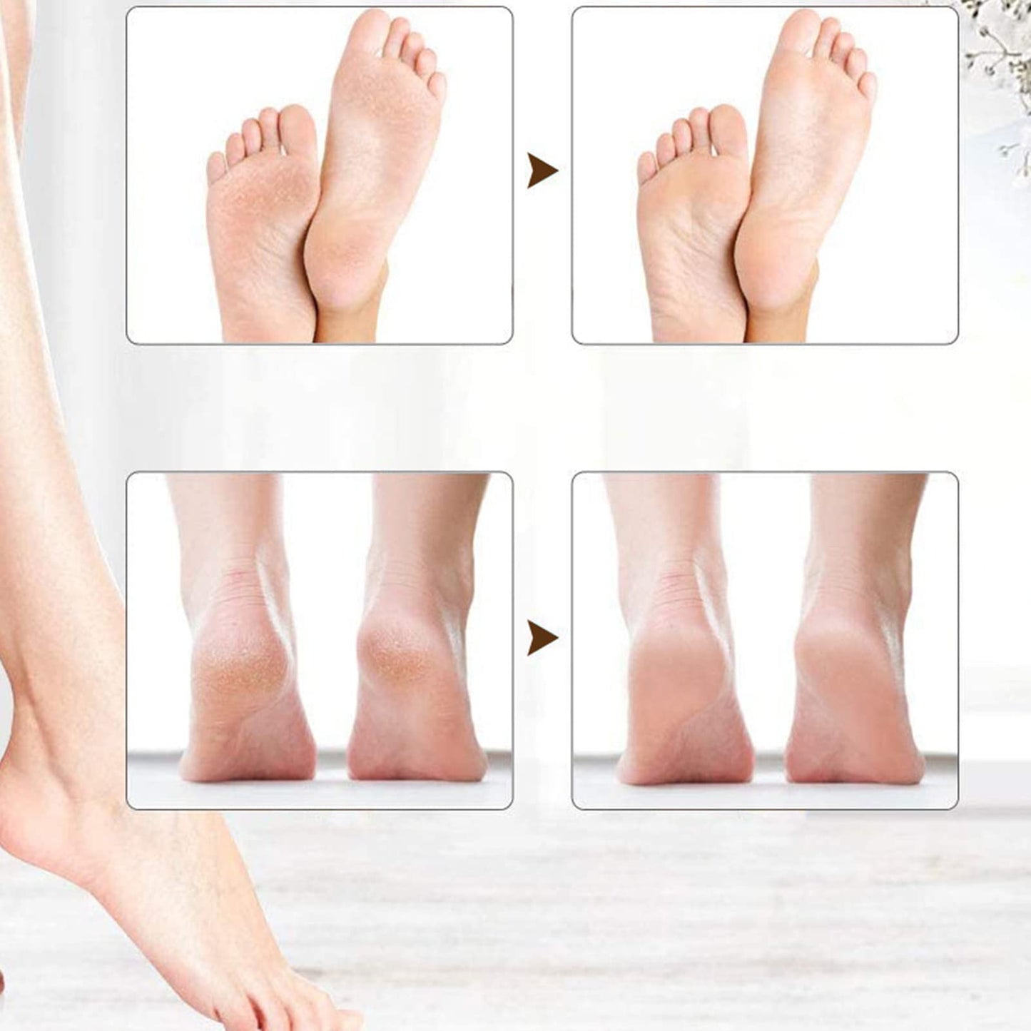 Asixxsix Foot Callus Remover, Rechargeable Electric Foot Callus Remover, Portable Foot Scrubber Professional Pedicure Tools, Foot File Pedicure Kits for Dead, Hard Cracked Dry Skin Gift
