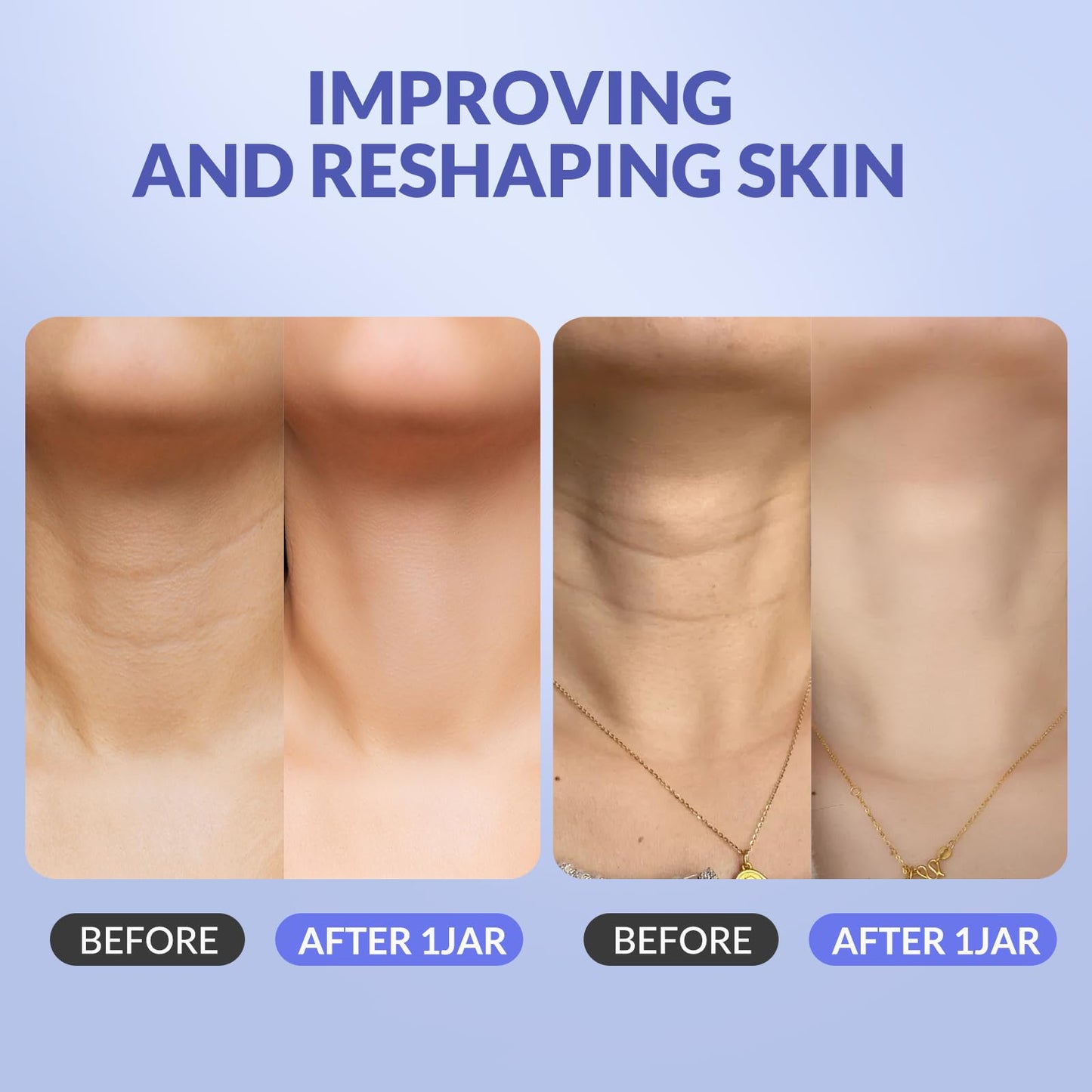 Crogooe Neck Firming Cream - Neck Creams for Tightening and Firming, Tightening and Lifting Wrinkles & Crepey Skin for Neck & Décolleté-1.7 fl.oz