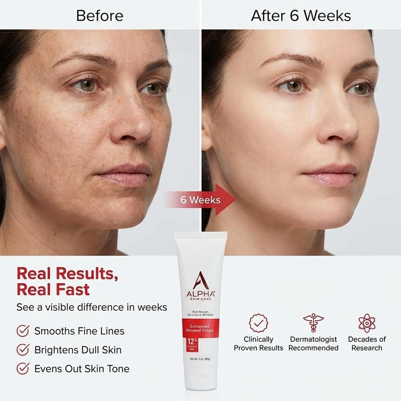 Alpha Skin Care Enhanced Renewal Cream, Anti-Aging Formula, 12% Glycolic AHA, Reduces Lines & Wrinkles, Normal to Dry Skin, 2 Oz, Pack of 1