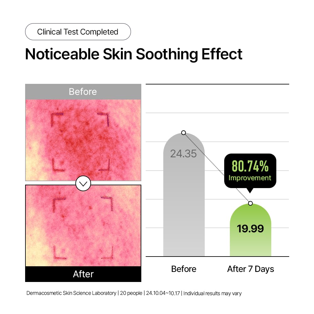 Parnell Panthenol 3.89% | 50ml / 1.69 fl.oz. | Heartleaf Calming Capsule Cream, Acne soothing cream, korea skin care, korea beauty