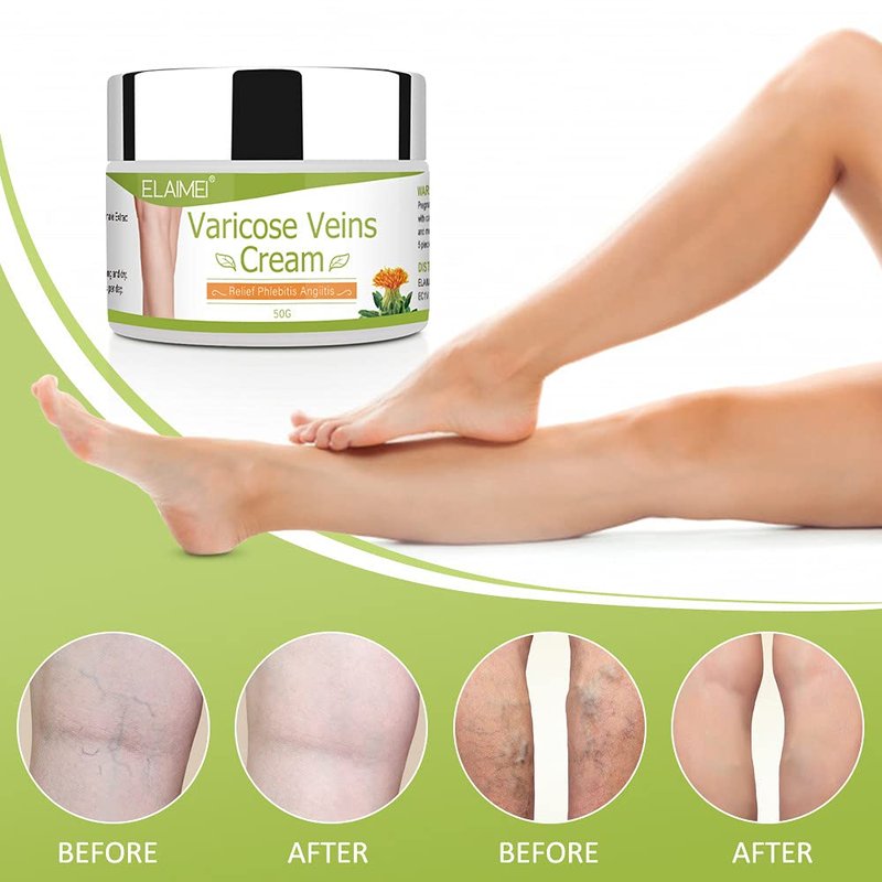Varicose Vein Cream for Legs - Boost Blood Circulation & Reduce Spider Veins | 3-Pack