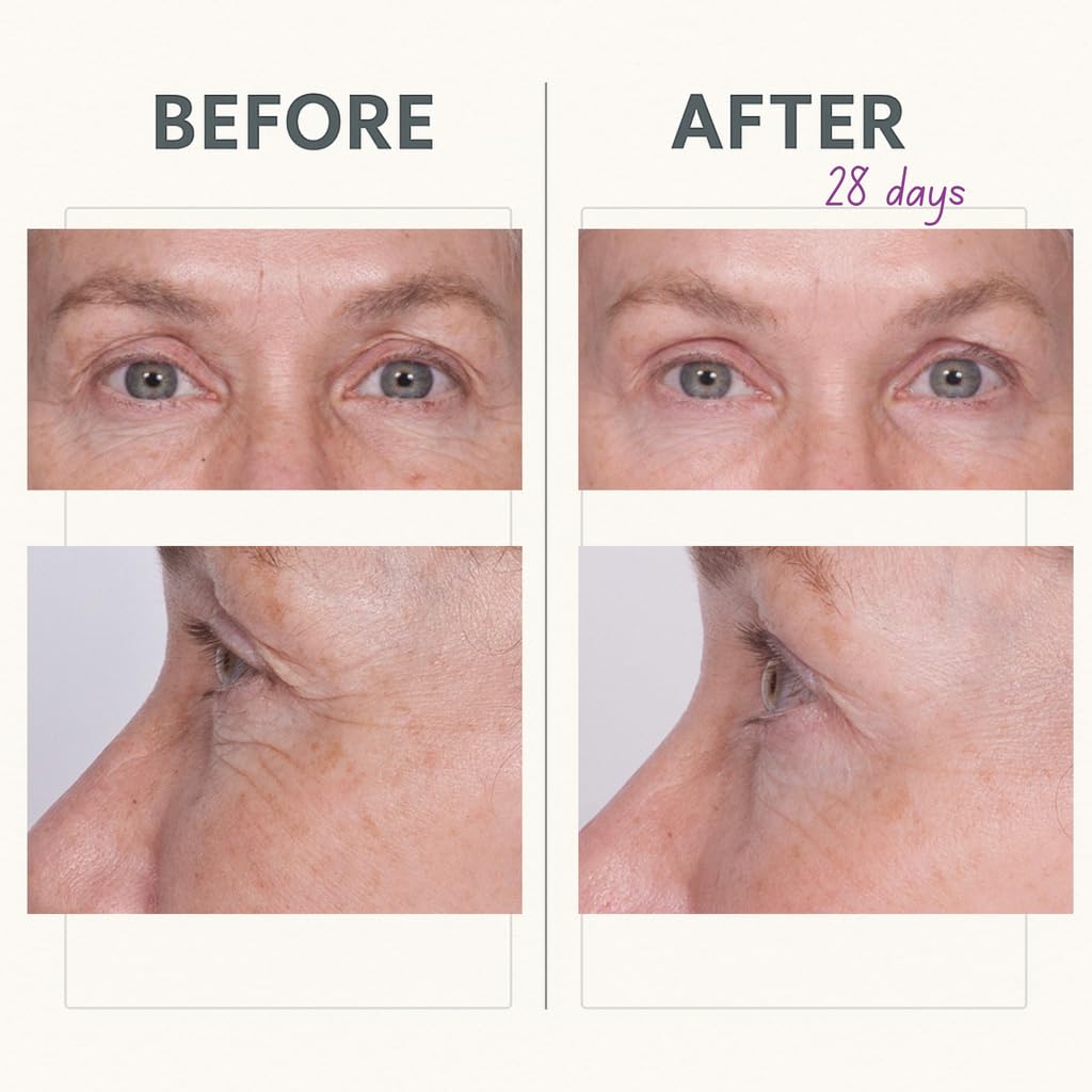 Serious Skincare Reverse Lift Firming Eye Cream with Peptides, Lift and Tighten Eyebrow, Under Eye, Hydrating, Smoothing Line & Wrinkle Formula, Anti-Aging Skin Care for Women, Men, 1 Oz