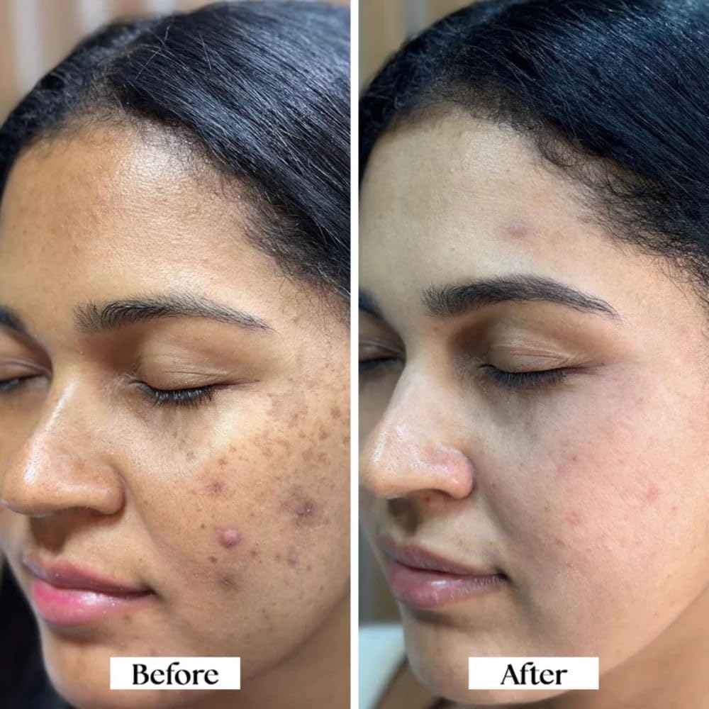 Organity Kaya Radiance Oil – Gotukola & Kumkum | Organic Moisturizer & Anti-Aging Serum for Women & Men | Hydrating Formula for Dry & Sensitive Skin – 20ml