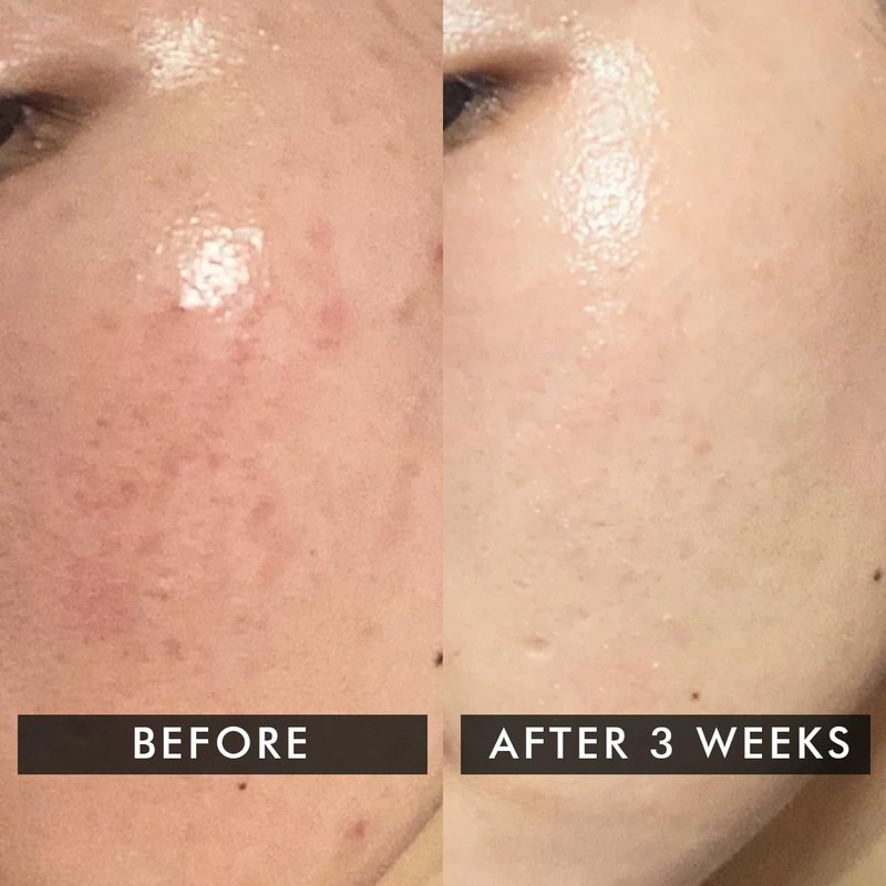 Snail Magic Skin Barrier Repair Cream - Daily Gel with Korean Snail Mucin Extract | 50g / 1.7fl. oz