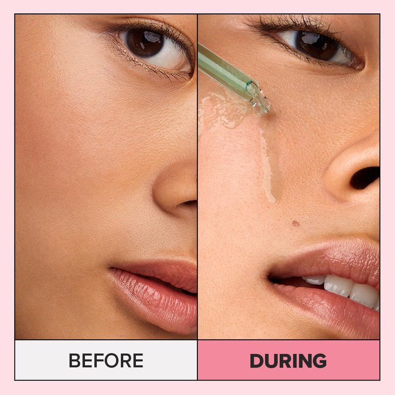 I DEW CARE Juicy Kitten | Purifying Power-Green Face Serum with Niacinamide | Korean Skin Care, Vegan, Cruelty-free, Paraben-free | Gifts For Mom and Women