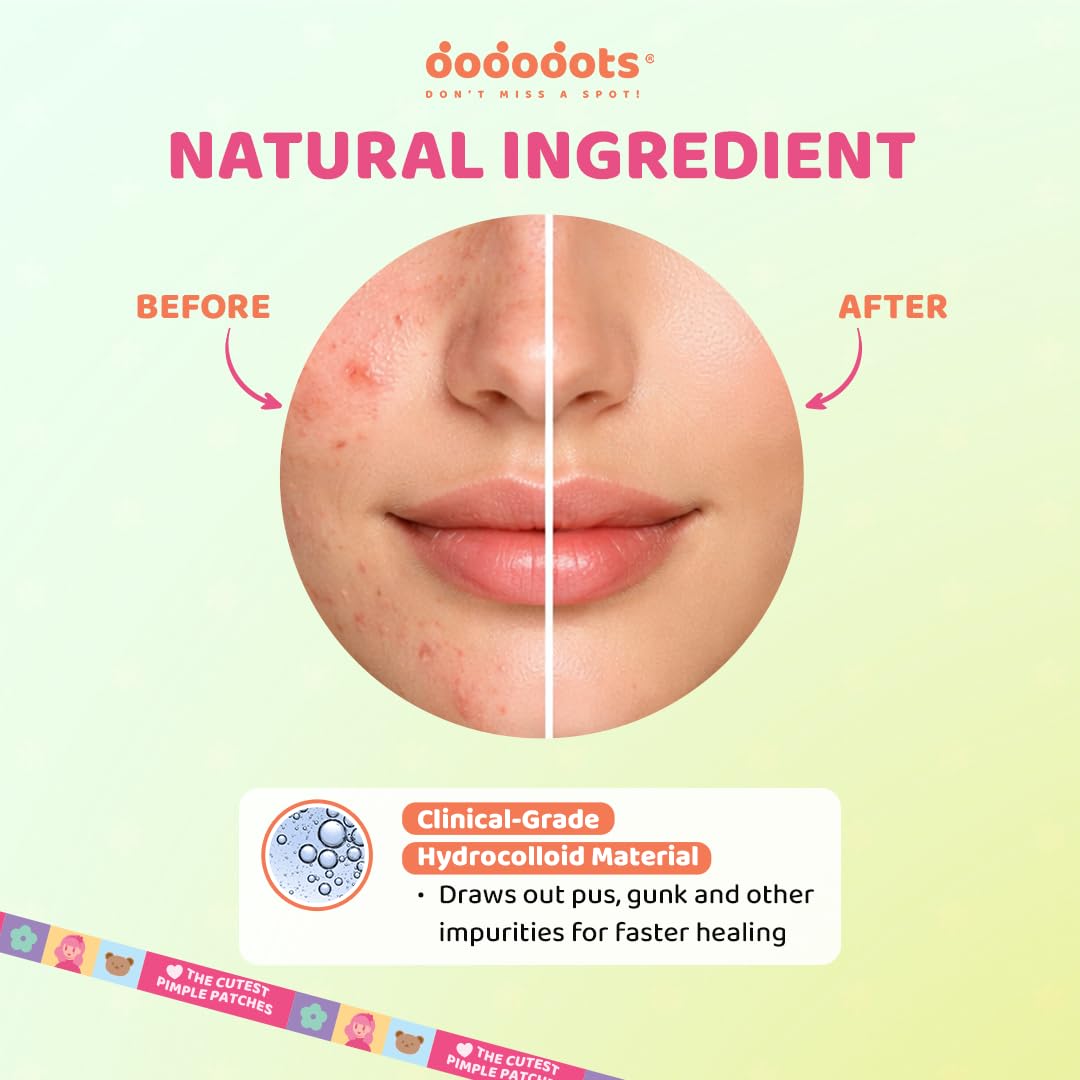 Dododots Pimple Patches for face - Cute Acne Hydrocolloid Patch, Pimple Patches for Zit, Spot and Blemish Treatment, Bundles (Butterfly, Cat, Flower and Heart)