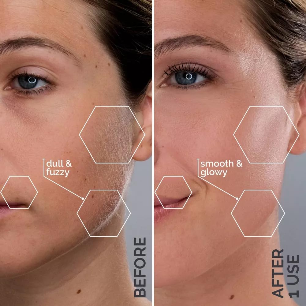 Spa Sciences SIMA DELUXE - Dermaplaning Tool for Painless Facial Exfoliation & Peach Fuzz Removal - 14 Weeks of Treatment Included