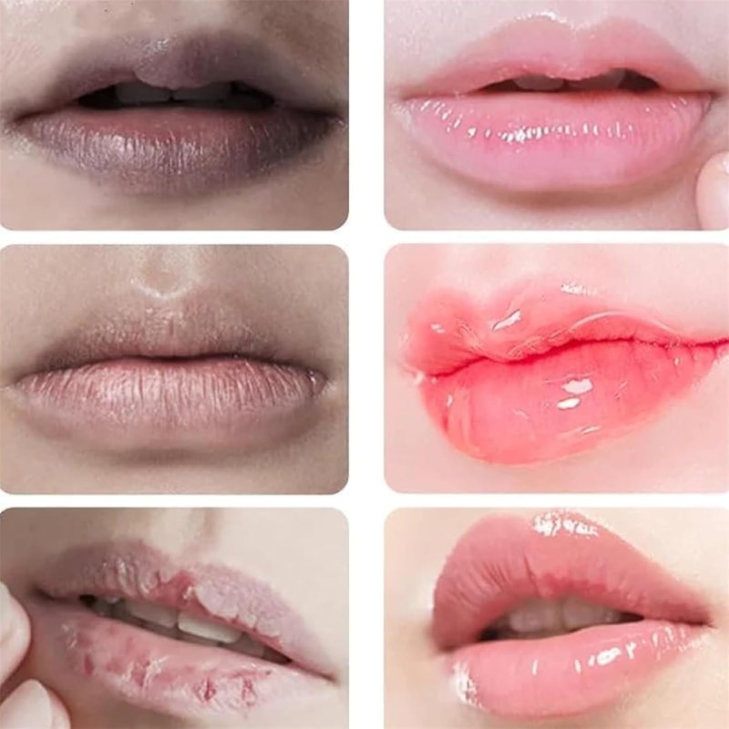 Lip Lightening for Dark Lips, Lip Brightening for Dark Lips, Dark Lip Treatment Serum for Smokers, Dry or Uneven, Restores Natural Look & Moisture with VC, Jojoba Seed Oil & Licorice
