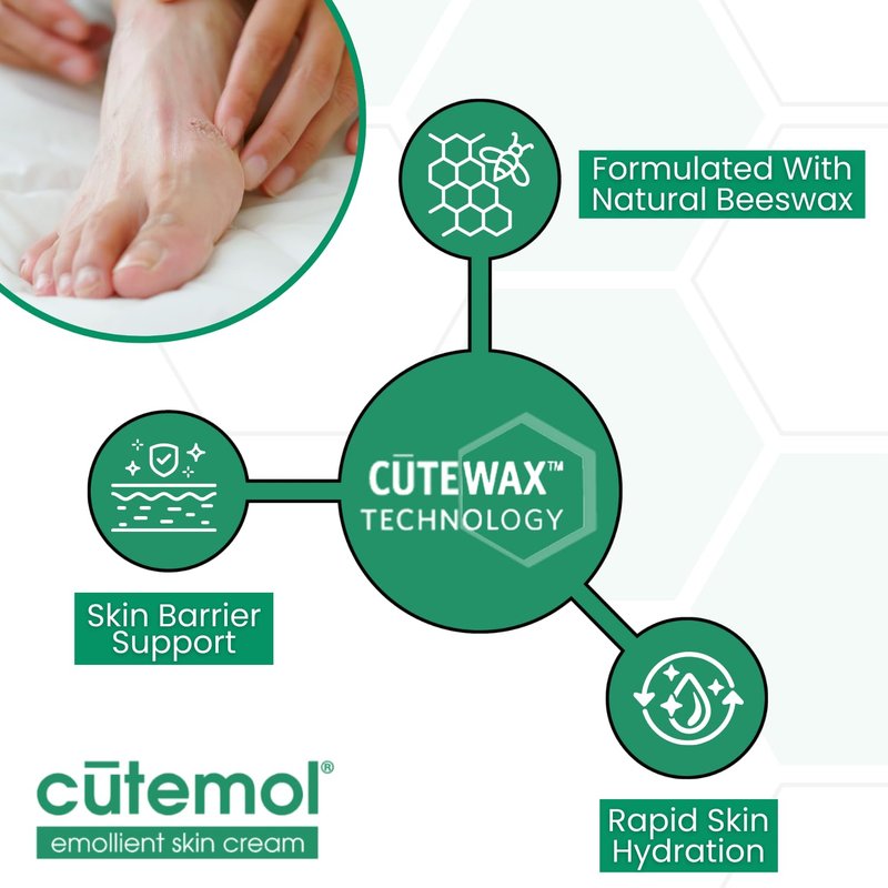 Cutemol Emollient Moisturizing Cream - Intensive Hydration for Dry, Damaged Skin | 2 oz Balm for Eczema & Psoriasis