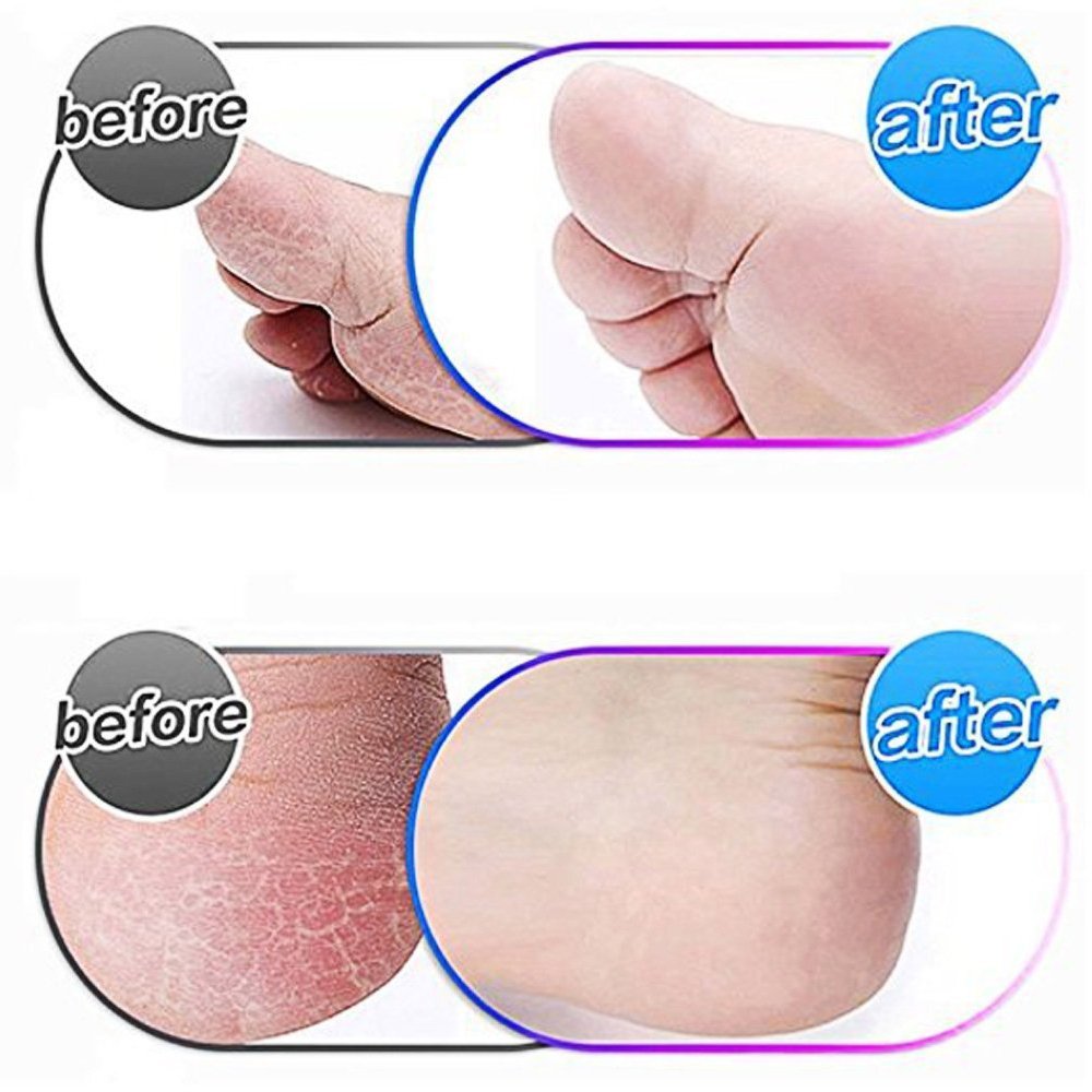 6 Pack Blue Extra Coarse Replacement Roller Refills Compatible with Scholl Express Pedi Foot Smoother Include a Cleaning Brush