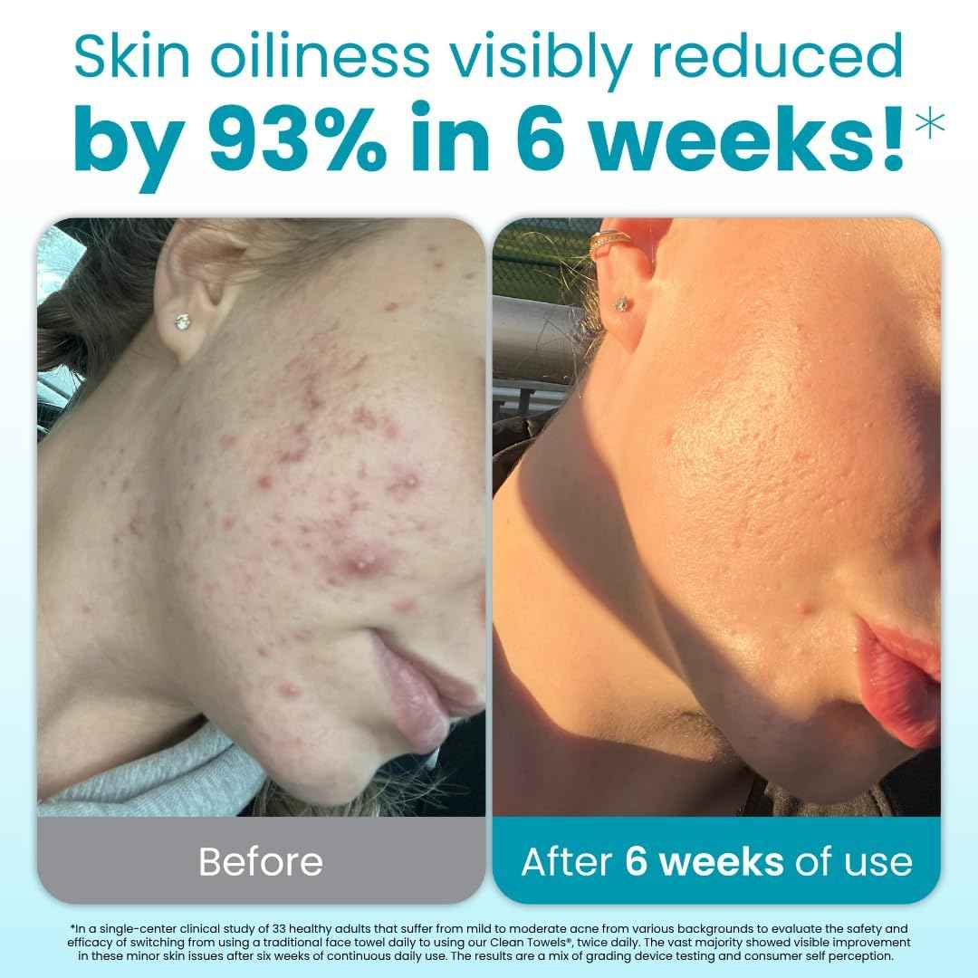 Clean Skin Club Blemish Control Clean Towels® XL, Compostable Face Towels, Light Exfoliation for Oily Skin, Eczema Association Accepted Disposable Face Towelette, Makeup Remover Dry Wipes, 50 count