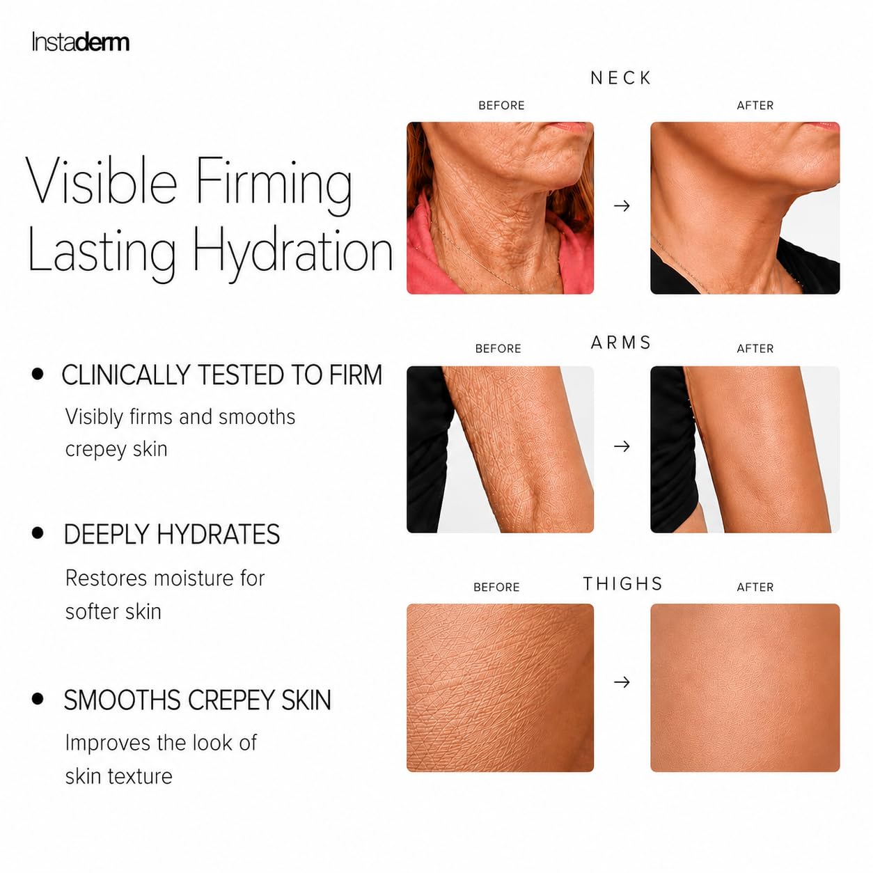 Instaderm Crepe Fix Body Cream – Anti-Aging Moisturizer for Neck & Body – Improve the Appearance of Thinning Aged Crepey Skin, Wrinkles & Dryness. Support Skins Natural Elastin & Collagen Production.