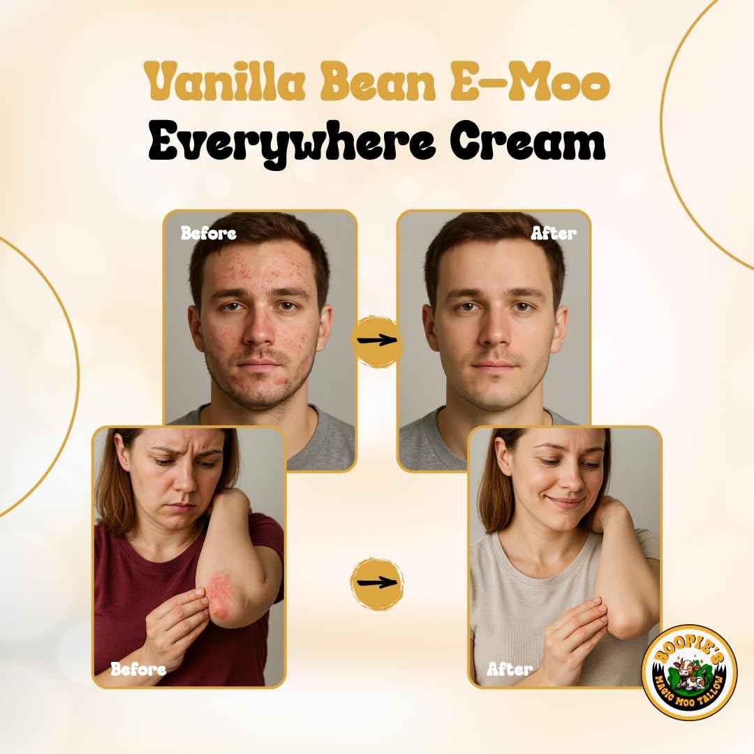 Magic Moo Tallow Vanilla Bean E-Moo Moisturizing Everywhere Cream with Organic Emu Oil. For acne, stretch marks, eczema, hyrdation, dry skin & more. 2oz