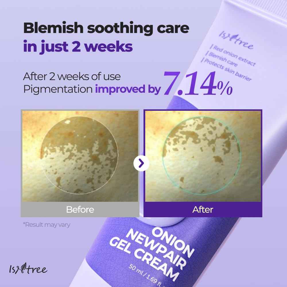 IsNtree Onion Newpair Gel Cream 50ml 1.69 fl.oz - Soothing Care | 3‑Layer Hyaluronic Acid| Moisturizing | 71 % Red Onion Extract | Non-Sticky & Non-Greasy l Skin hydration I Korean Skincare