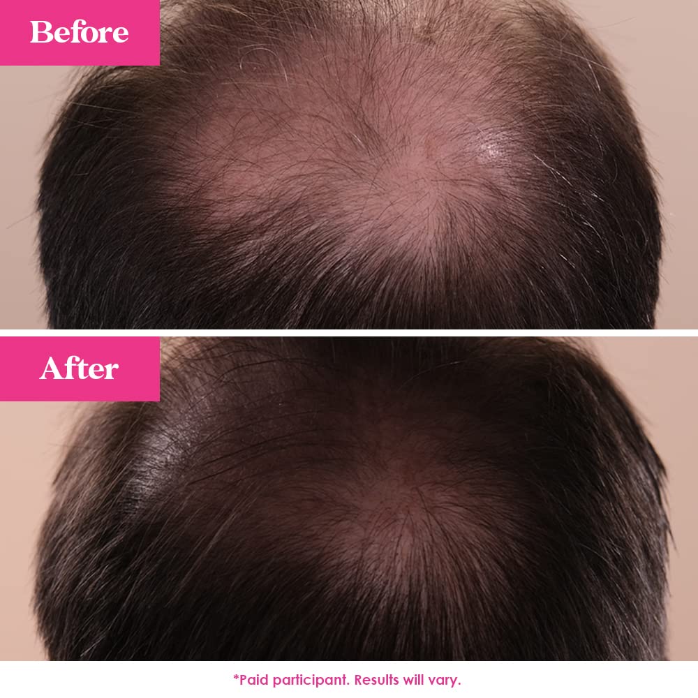 Grande Cosmetics GrandeHAIR Enhancing Hair Serum - for Men & Women, for Fuller & Thicker-Looking Hair in 8 weeks, Safe for Color-Treated Hair (40 mL)