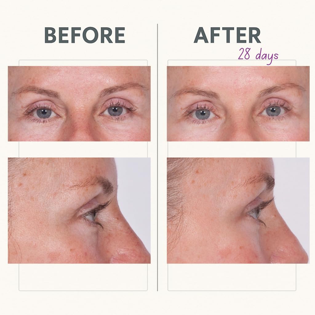 Serious Skincare Reverse Lift Firming Eye Cream with Peptides, Lift and Tighten Eyebrow, Under Eye, Hydrating, Smoothing Line & Wrinkle Formula, Anti-Aging Skin Care for Women, Men, 1 Oz