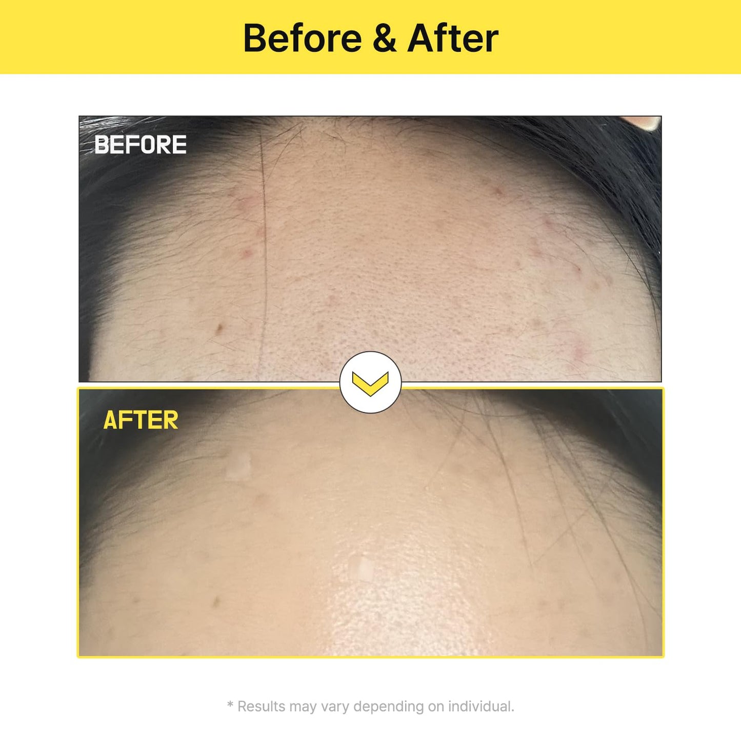 TIA'M Alpha-5 Mela Care Cream, 1.69 fl oz, 5% Alpha Arbutin Glow Enhancing Cream with Glutathione & Niacinamide, Korean Skin Care