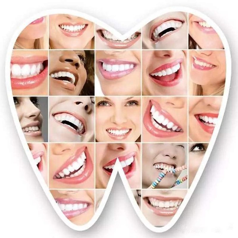 200Pcs Tooth Brace Teeth Model Mini Roth Brackets Roth 022 Slot Bondable with Hook on 347 (200pcs-Black)