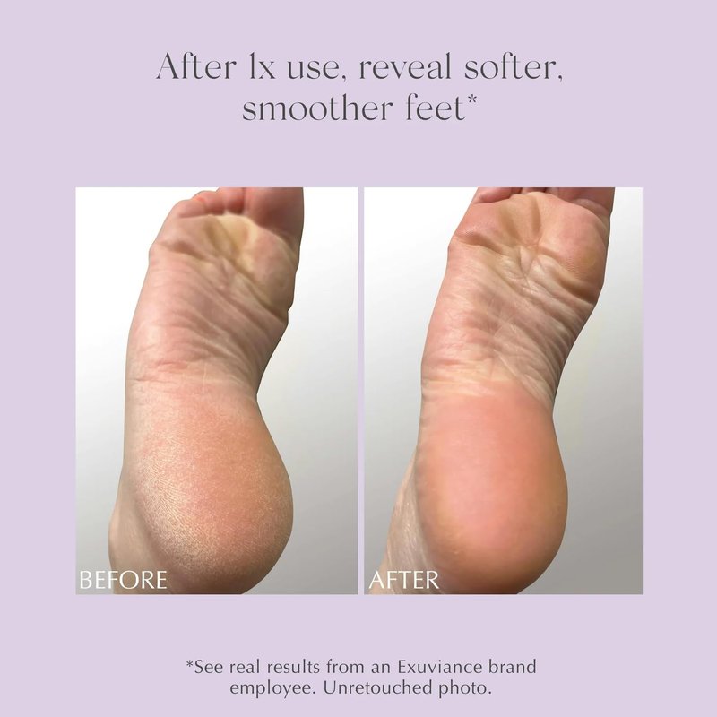 Exfoliating & Conditioning Foot Balm - Deep Moisture & Softness | 1.7 oz