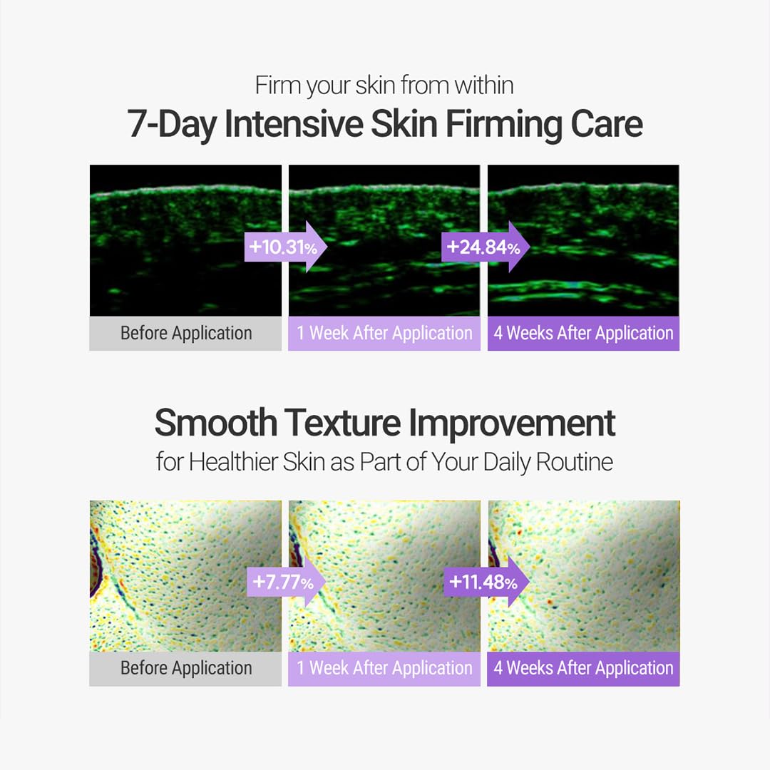 ROVECTIN Retinosine Deep Intense Cream - Retniol 0.15%, Adenosine, Hydrolyzed Collagen, Bakuchiol | For sensitive skin, Korean Skin Care - (1.01 fl.oz, 30ml)