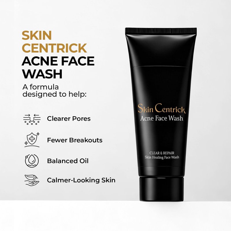 Clarifying Acne Control Face Cleanser - Salicylic Acid & Niacinamide for Oily Skin | Unclogs Pores, Fights Breakouts