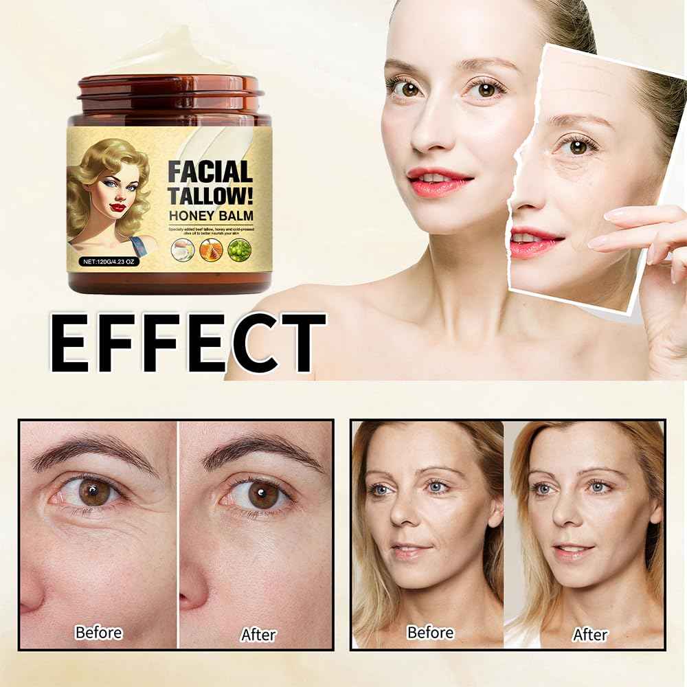 Cebo de Res Para la Cara Original, Beef Tallow for Skin, Tallow and Honey Balm, Whipped Tallow Honey Balm, Sebo de Res Para la Cara (1 pcs cebo de res)