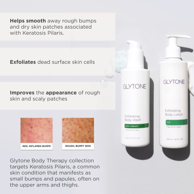 GLYTONE Glycolic Acid Body Wash – Exfoliating & Moisturizing Body Wash for Dry Skin, Reduce Keratosis Pilaris – Fragrance-Free Exfoliator with Glycolic Acid for Rough & Bumpy Skin, 2 Fl Oz
