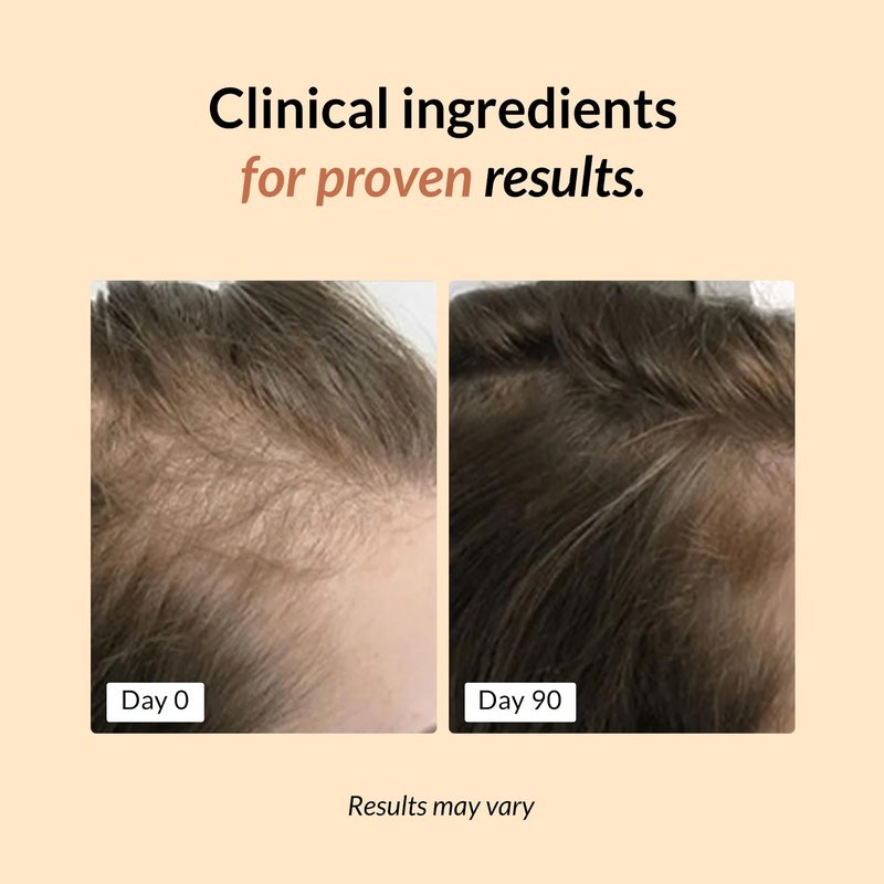 FullyVital Hair Growth Supplement for Women, Ages 35 and Up, Science-Backed Hair Vitamins for Thicker, Fuller Hair with Biotin, Saw Palmetto - Dermatologist Recommended (1 Month Supply, Vegan)